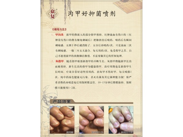 眾復(fù)溝甲好抑菌噴劑
