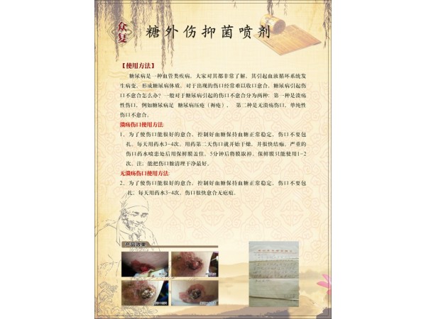 眾復唐高外抑菌噴劑