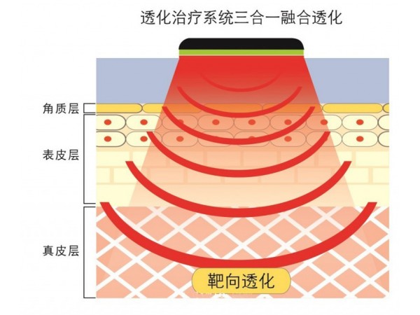 透化治療系統