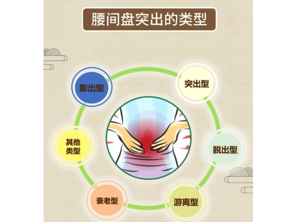 遠紅外磁療貼廠家黑膏藥貼pu膜防水防汗外用貼劑可貼牌代加工