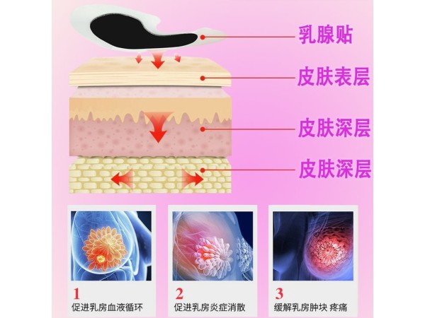 東進(jìn)藥業(yè)乳腺貼代加工 醫(yī)院藥店供貨乳腺貼代加工 乳腺貼oem貼牌代加工